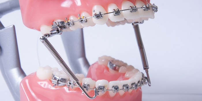 Ortodoncia: Importancia y estudios previos