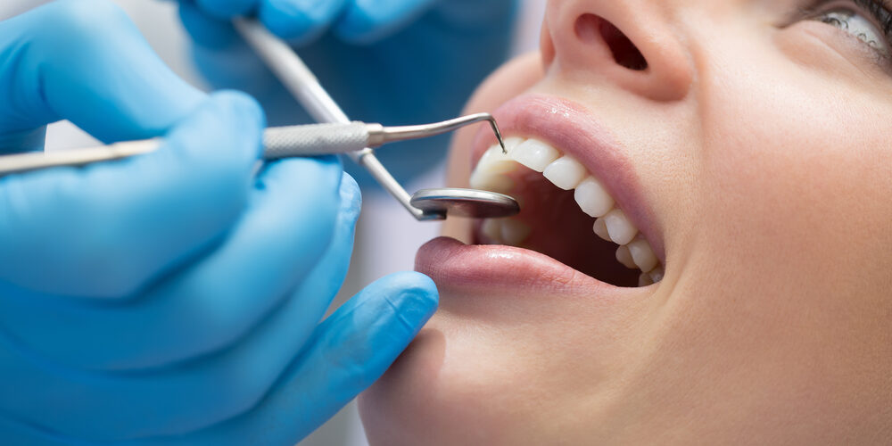 Dentistas en DF | La importancia de las revisiones dentales periódicas